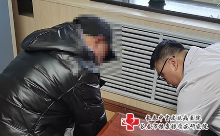 [长春市治疗皮肤病医院]患者在治疗牛皮癣时该怎么做