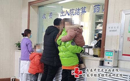 [长春牛皮癣选中吉精心]牛皮癣要注意口腔卫生吗