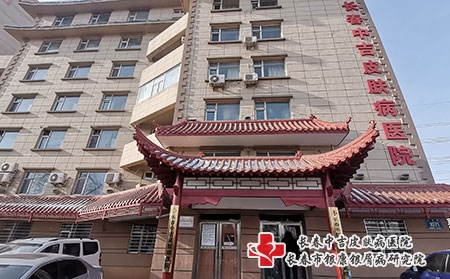 [长春牛皮癣问中吉放心]导致头部牛皮癣发病的原因是什么