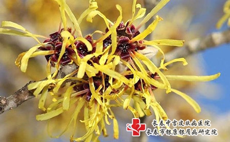 [长春专治皮肤病肯定中吉]如何才能防止湿疹反反复复的发作