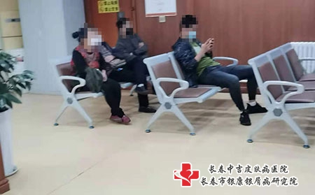 长春哪家医院治疗胎记好?治疗胎记多久能好?