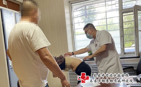 长春胎记的医院排名?青胎记是怎么形成的? 长春胎记的医院排名?青胎记是怎么形成的?
