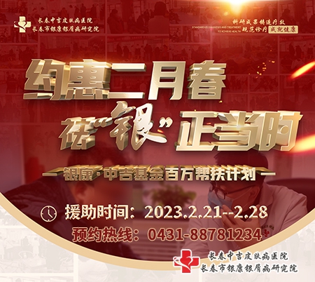 长春市中吉医院2月春季银屑病治疗优惠活动