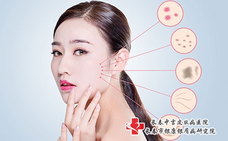摄图网_500764539_女性皮肤病（企业商用）
