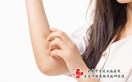 摄图网_501768220_女性手臂瘙痒过敏特写（企业商用）
