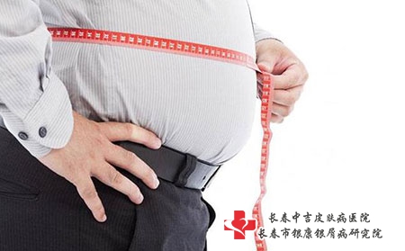 2 (156)肥胖 2 (156)肥胖