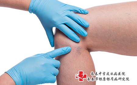摄图网_303522806_医生亲手检查女腿和紧闭的容器上变血管（企业商用）关节
