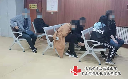 长春市网络牛皮癣-长春治疗银屑病治疗方法