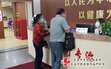 长春市中医牛皮癣-长春怎么有效治疗银屑病