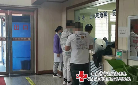长春市专治牛皮癣-长春哪个地方看银屑病好