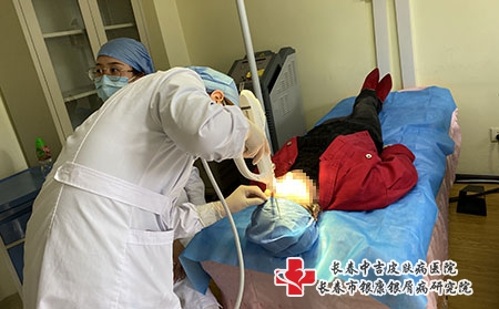 长春好治疗牛皮癣-长春市中吉银屑病研究所