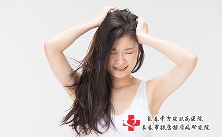 摄图网_501713659_脱发问题抓头苦恼的年轻女性(企业商用) 摄图网_501713659_脱发问题抓头苦恼的年轻女性(企业商用)
