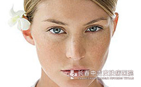 雀斑危害