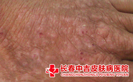 皮肤瘙痒怎么办