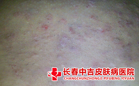 皮肤瘙痒的病因