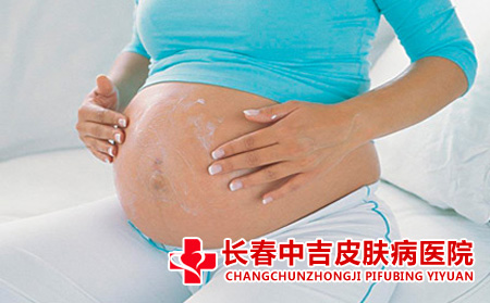 孕期雀斑是否消退