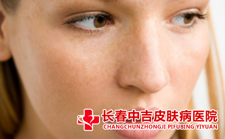 雀斑对患者有什么危害