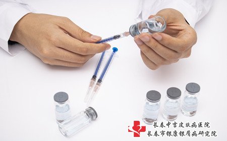 牛皮癣治疗,身上有牛皮癣怎样治