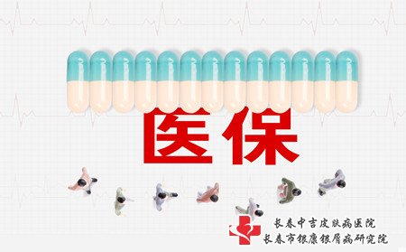 长春治牛皮癣价格,长春治牛皮癣费用