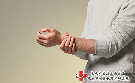 银屑病关节炎肘关节疼痛