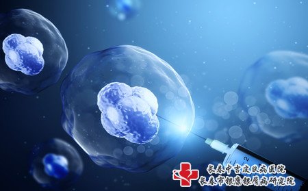 青少年牛皮癣治疗,怎样治青少年牛皮癣