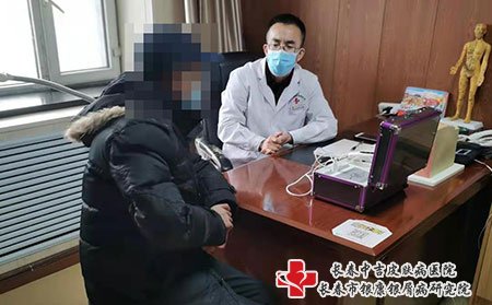 牛皮癣治疗方法有哪些