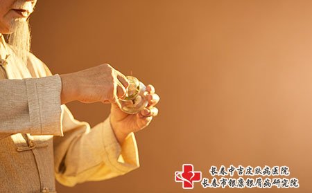 长春银屑病专科 拔火罐治疗牛皮癣