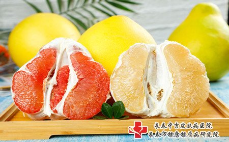 怎样预防雀斑,雀斑要怎样预防