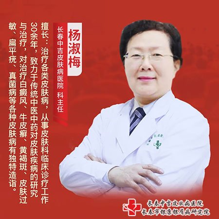 长春中吉皮肤病医院杨淑梅主任
