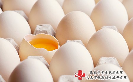 白癜风