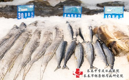 白癜风