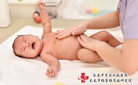 湿疹