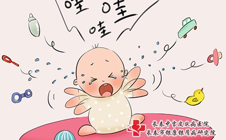 湿疹