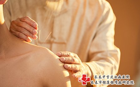 针灸