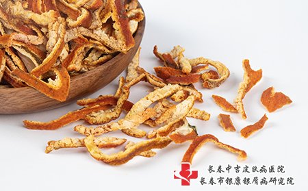 慢性荨麻疹