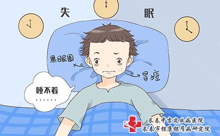 痤疮