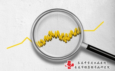 有牛皮癣怎样治,牛皮癣如何治疗