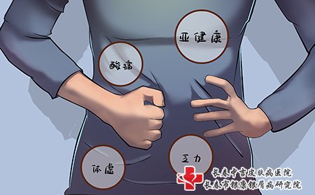 带状疱疹