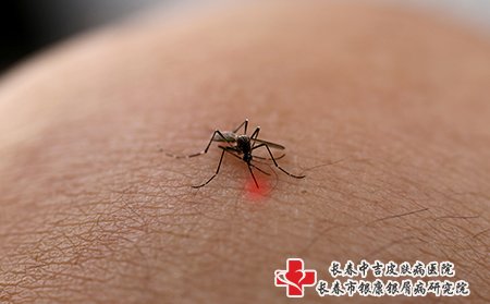 蚊虫叮咬也会导致皮肤瘙痒