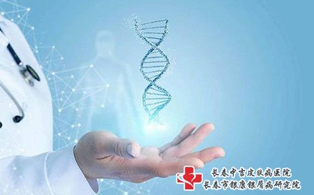 长春银康医生牛皮癣医院,长春牛皮癣医院,长春牛皮癣医院医生,牛皮癣检查