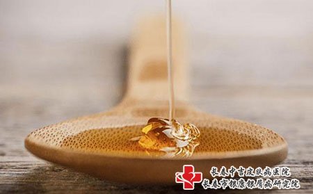 长春银康治疗银屑病的医院：面部牛皮癣的病因分析