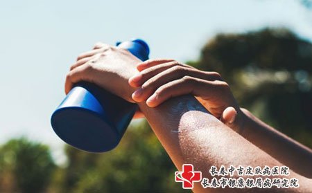 长春银康治疗牛皮癣：选择牛皮癣的外用药注意事项