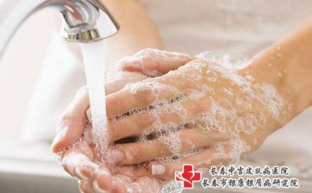 长春银康牛皮癣医院告诉您牛皮癣一般要做哪些检查