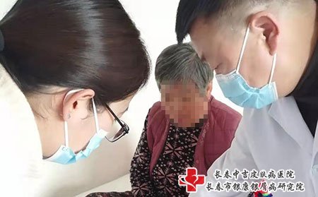 长春市银康,长春市银康牛皮癣,牛皮癣紫外线光疗仪