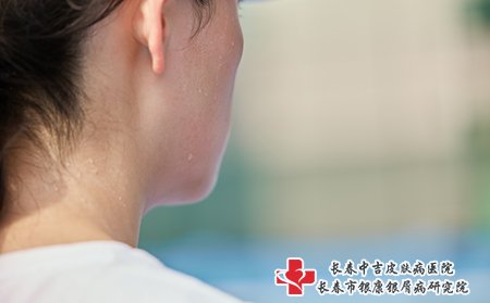 皮肤流汗瘙痒要及时补充水分