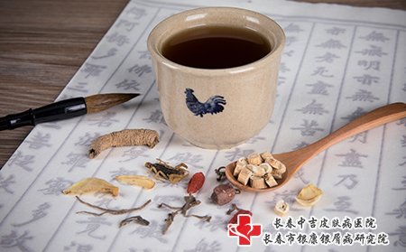 带状疱疹可以用中药调理
