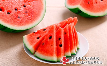 带状疱疹可以吃西瓜