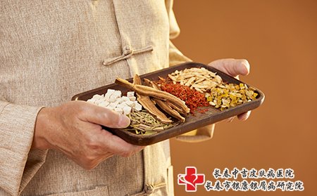 带状疱疹可以口服中西药结合
