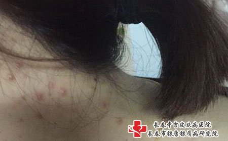 维生素b6只能起到辅助效果