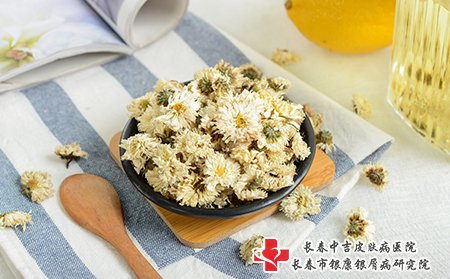 痤疮可以喝些菊花茶